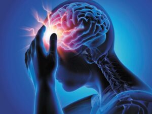 Brain-Injuries suffered from car accident